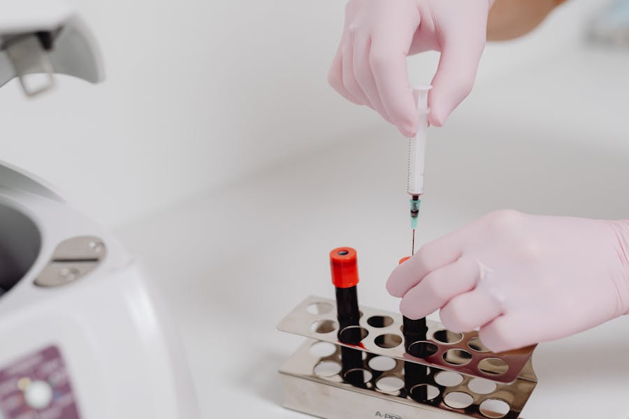 PRP — Plasma y Fibrina Rico en Plaquetas